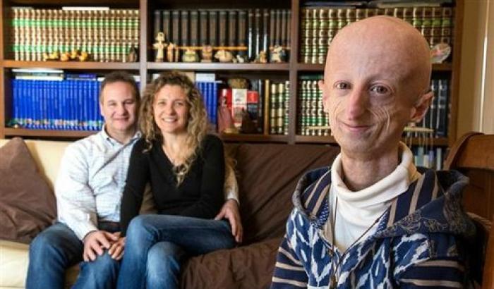 Sono fragile e ho un aspetto singolare: Sammy ospite di Sanremo