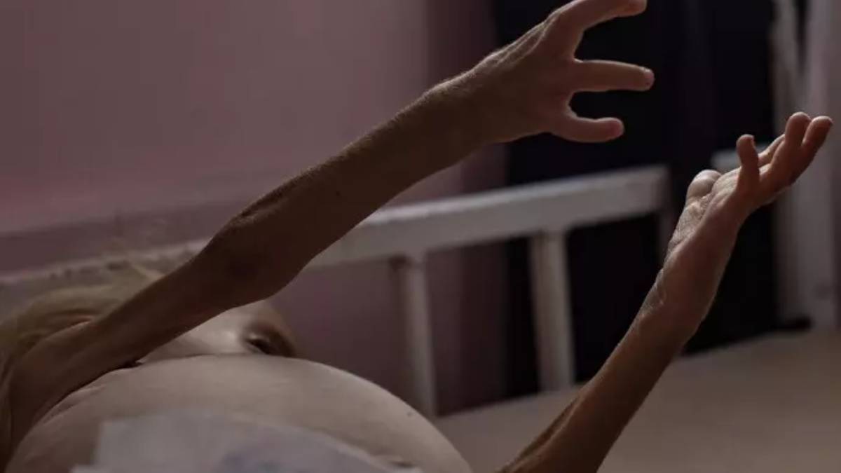 Onu, nuovi dati su malnutrizione e carestia a Gaza